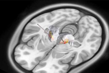 Thinking outside the box: Uncovering a novel approach to brainwave monitoring